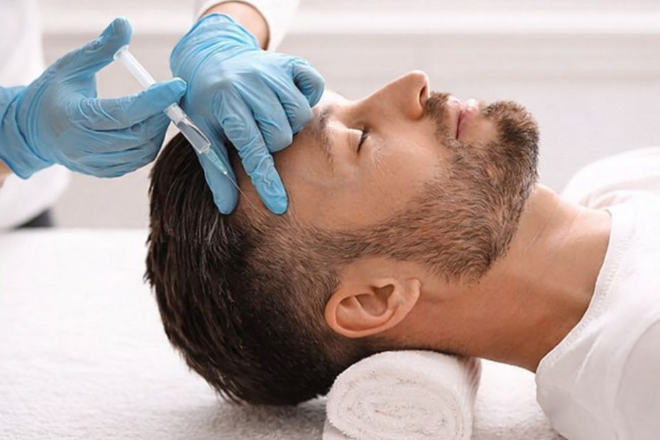 En man får PRP-injektioner i hårbotten för håravfall.